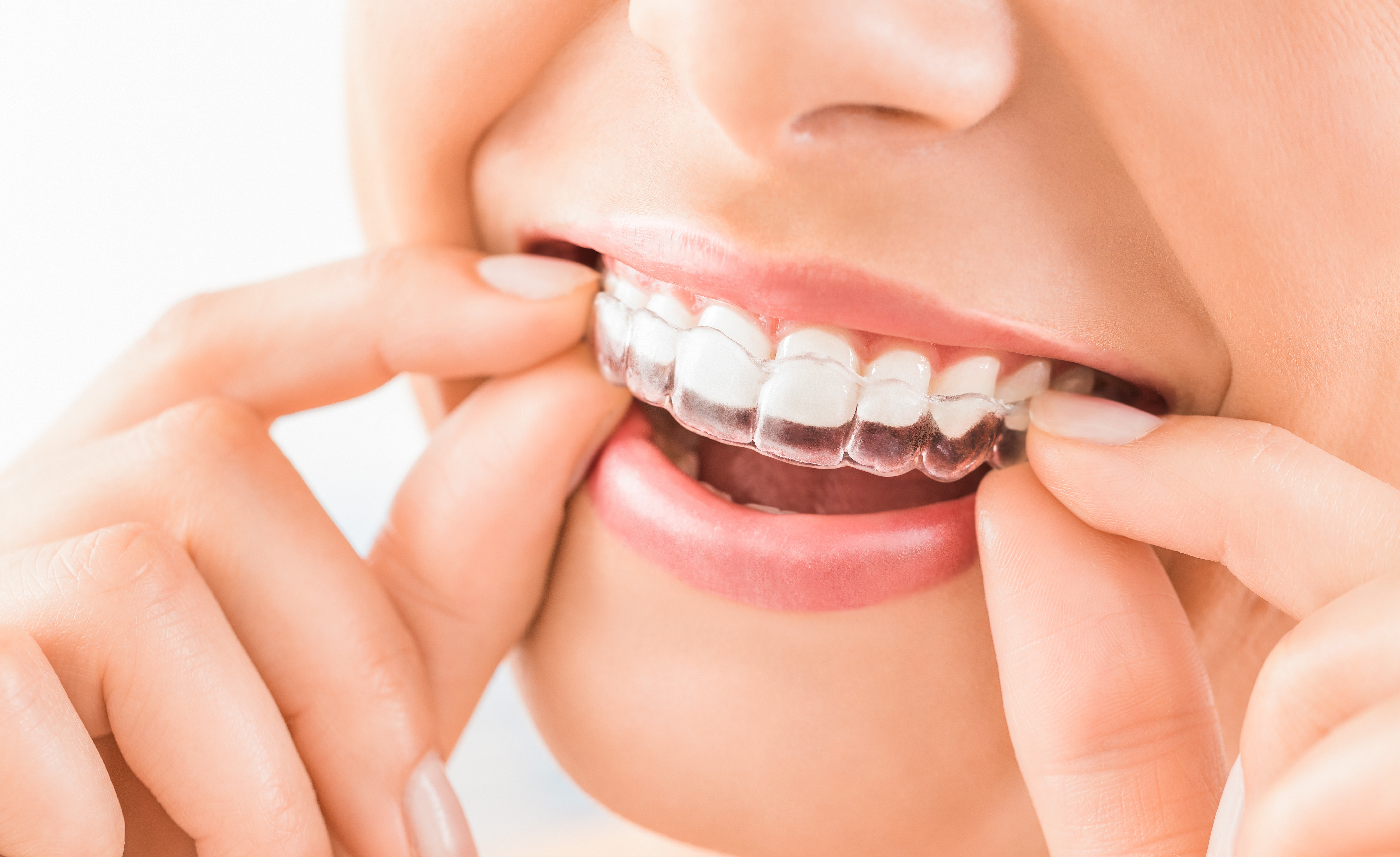 Dental Care for the Whole Family