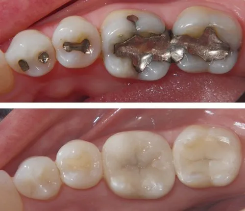 best-dentistry-fillings-logan best-dentistry-fillings-logan