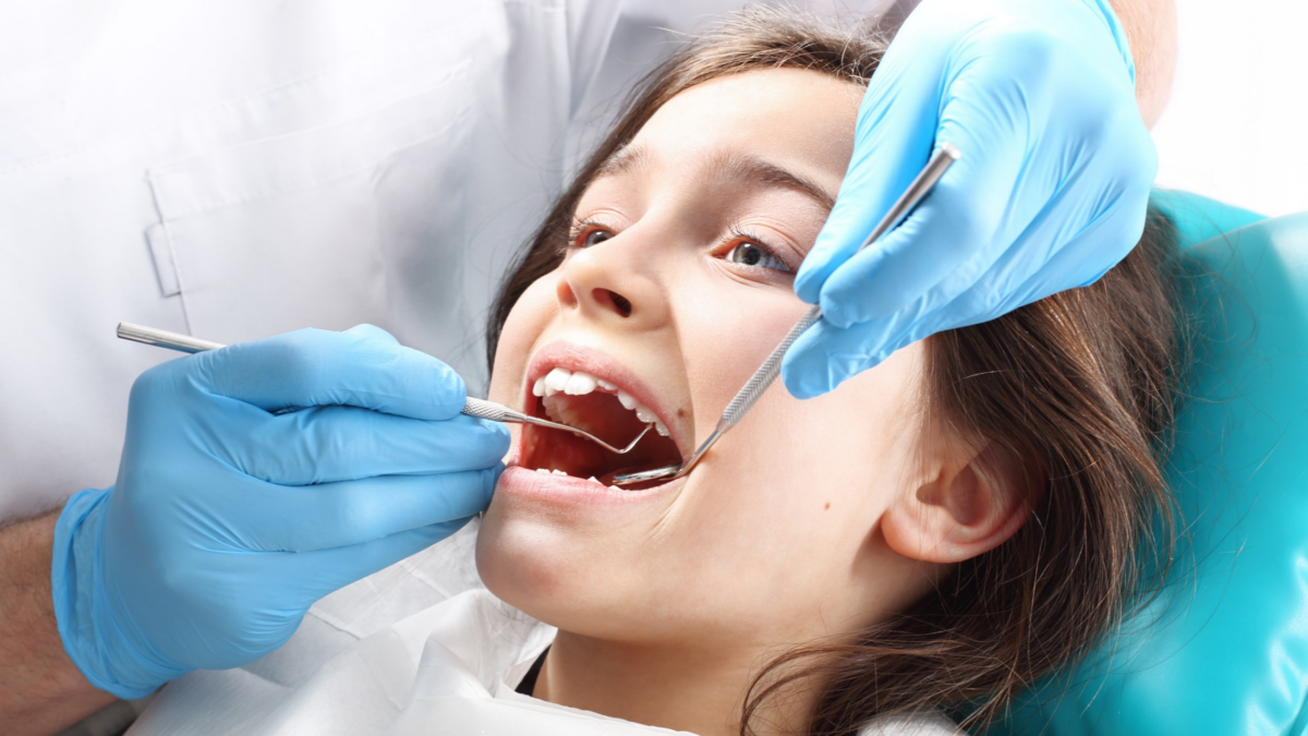 dental-sealants-1200x675.png